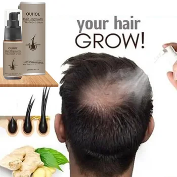 Silný Rast Vlasov Sérum Sprej Zázvor Anti Hair Loss Treatment Produkty Opravy Vyživujú Vlasové Korienky Rýchlo Opätovný Rast Vlasov Muži Ženy